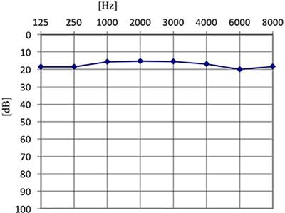 Excitation of the Auditory System as a Result of Non-invasive Extra-Cochlear Stimulation in Normal Subjects and Tinnitus Patients